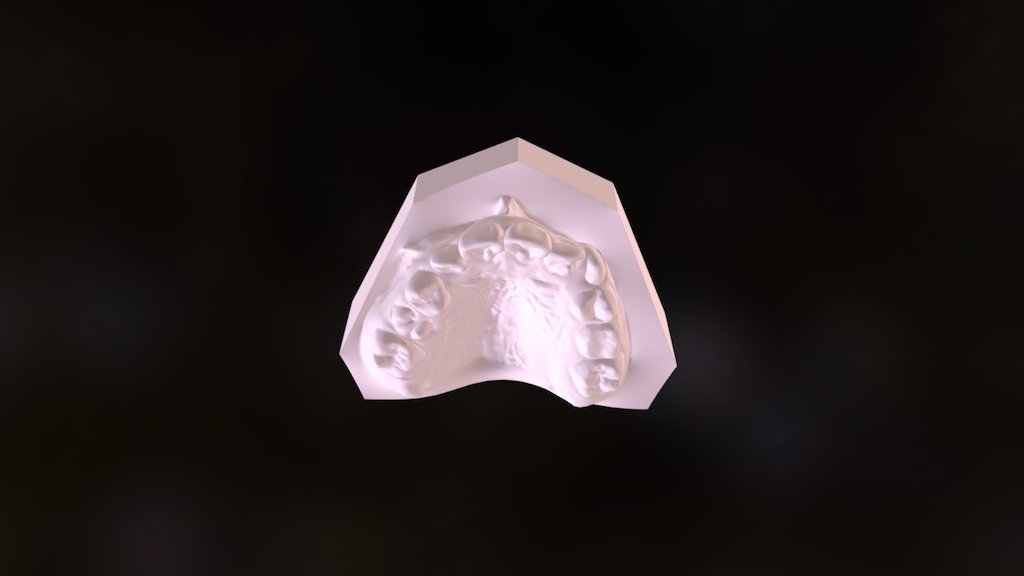 Modelo superior en dentición mixta — Sketchfab embed 3D viewer