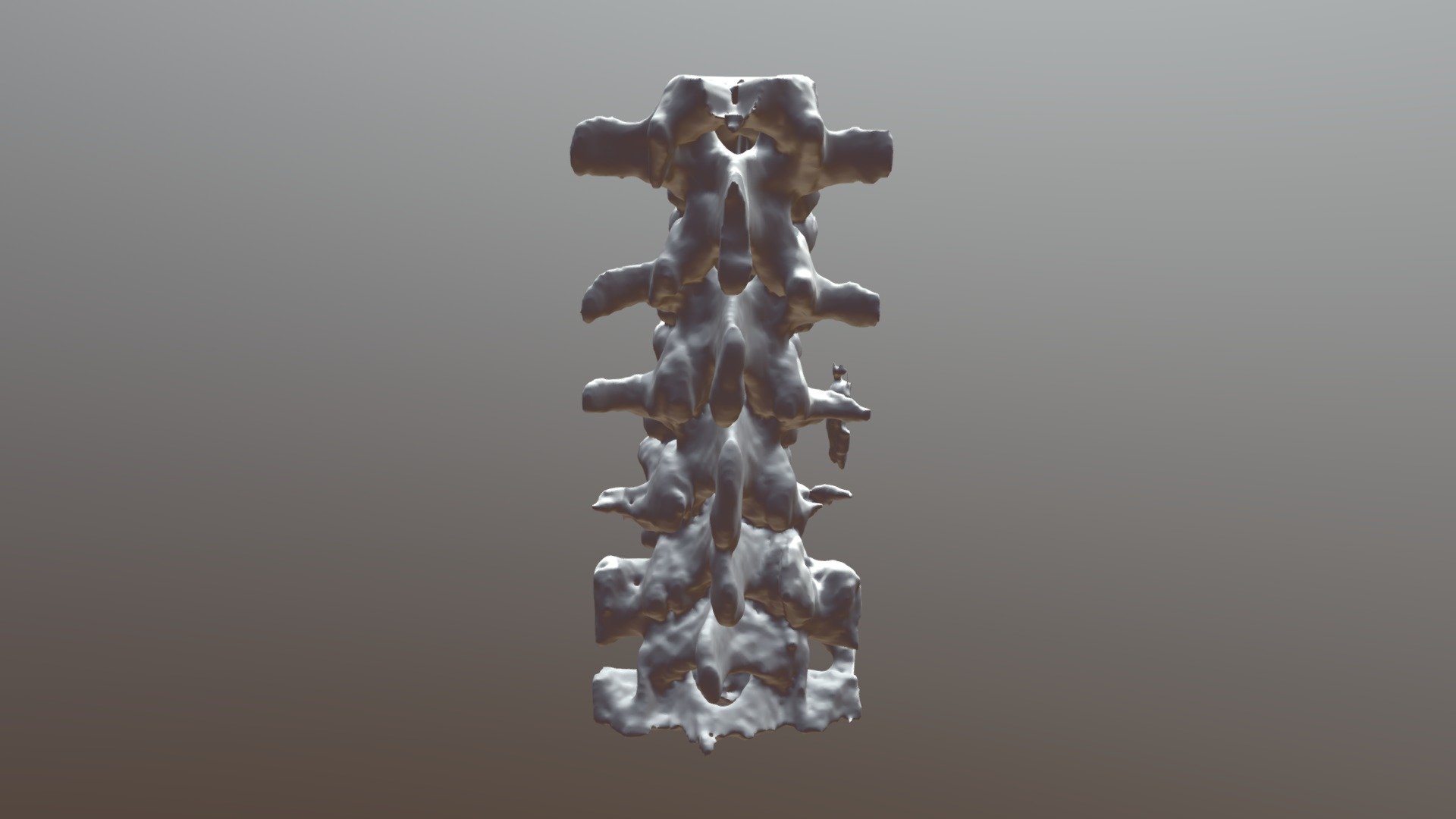 spine