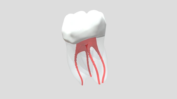 Endodontic #36 3D Model