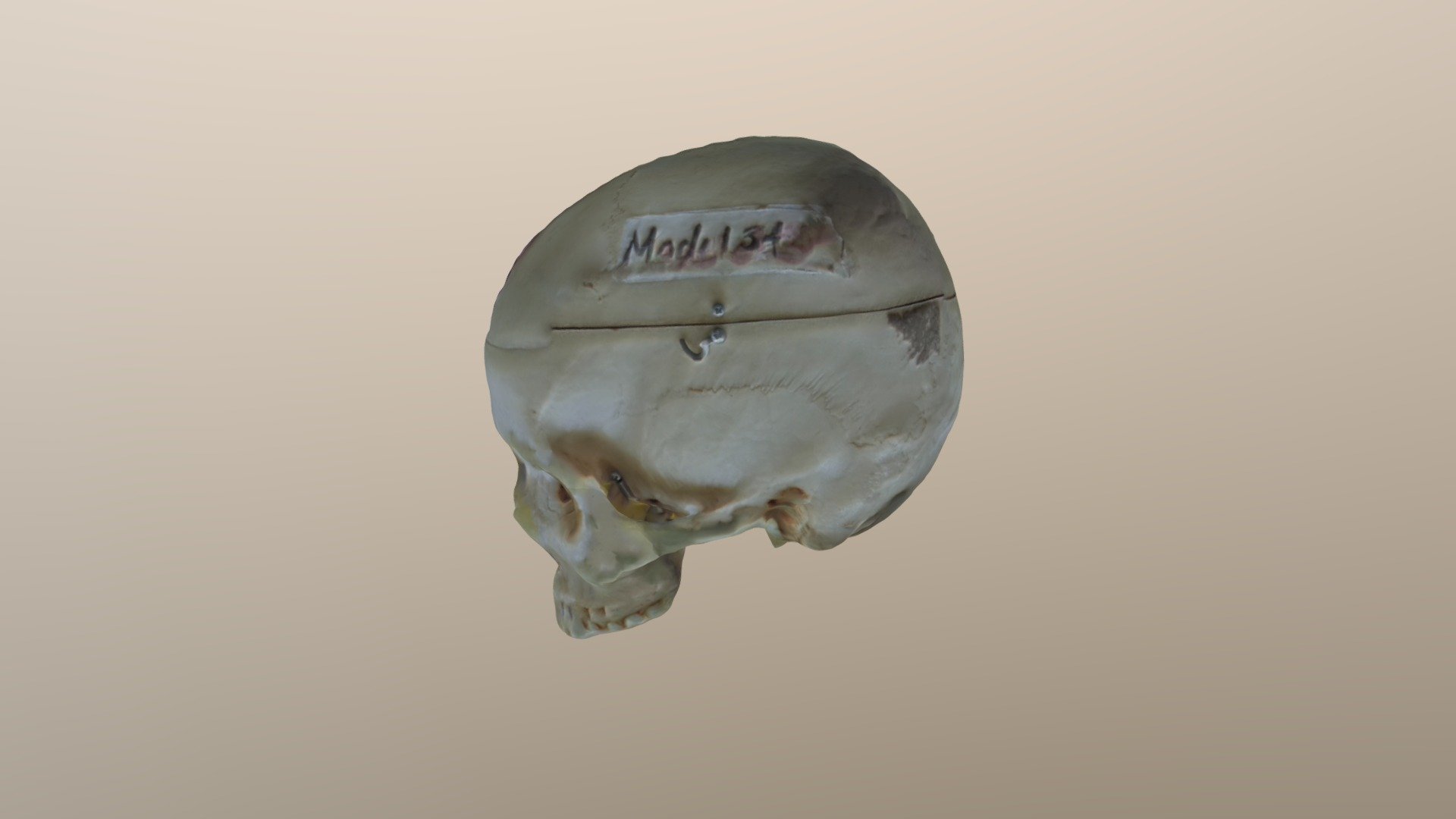Skull