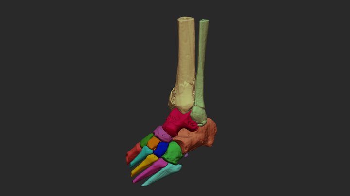 Caso_5_Tobillo_Modelo_Color 3D Model