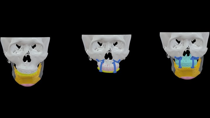 Dr.許-賀O毅-0212 3D Model