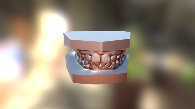 矯正前 3D Model