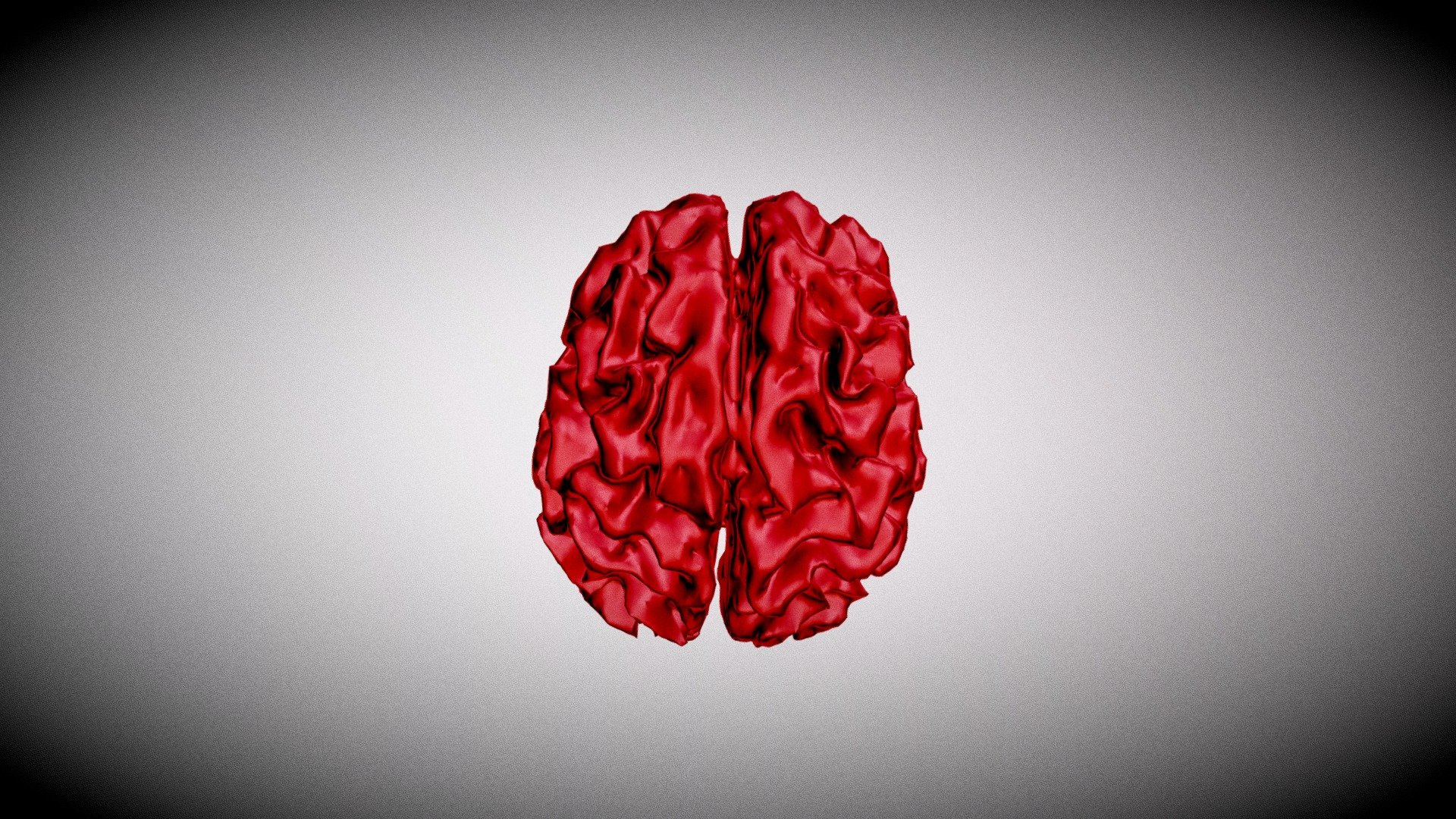 Alzheimer's Brain