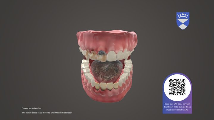 Illicit & Recreational Drugs Exposure Pattern 3D Model