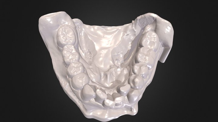 Mandibular Arch Case OO 3D Model