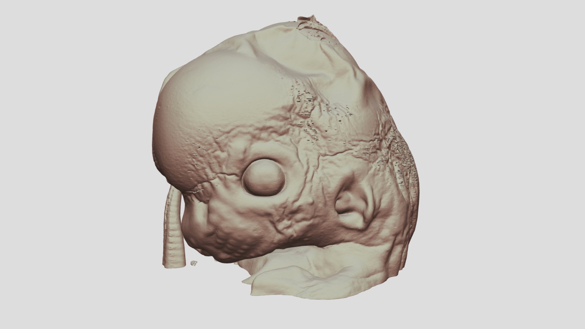 E13.5 Mouse Embryo Head
