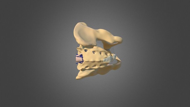 Pediatric Pelvis, Sacrum 3D Model
