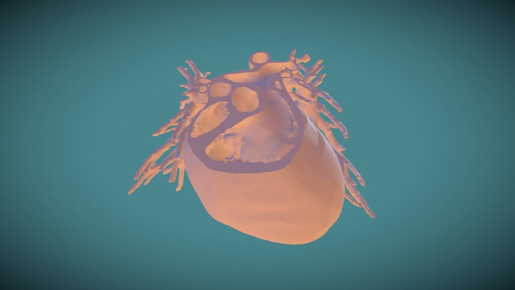 Heart model from CT