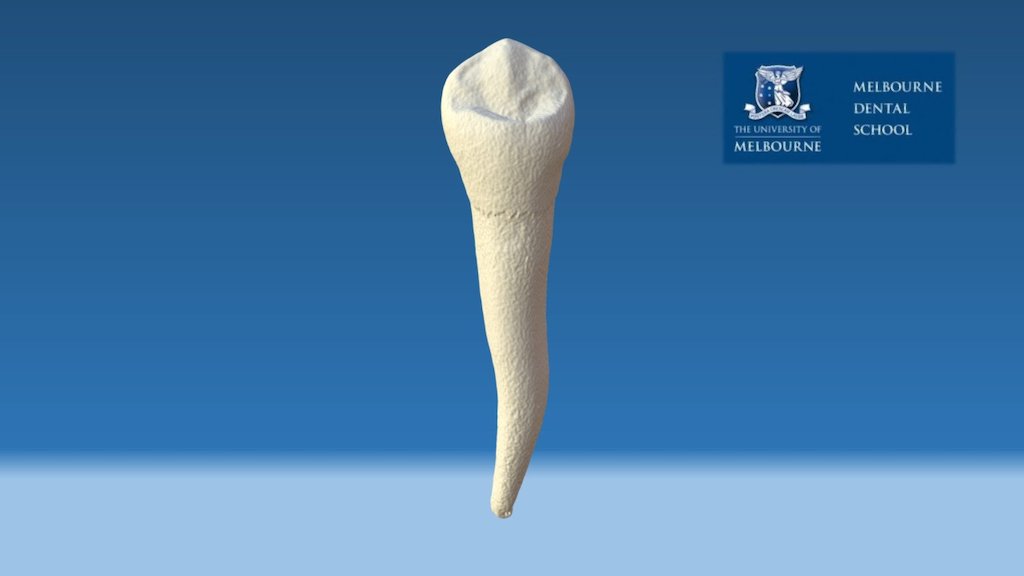 Human lower left first premolar (FDI 34)