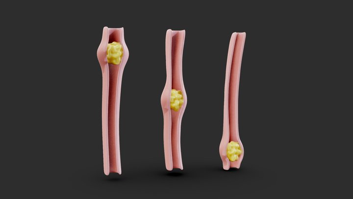 Peristalsis Function 3D Model