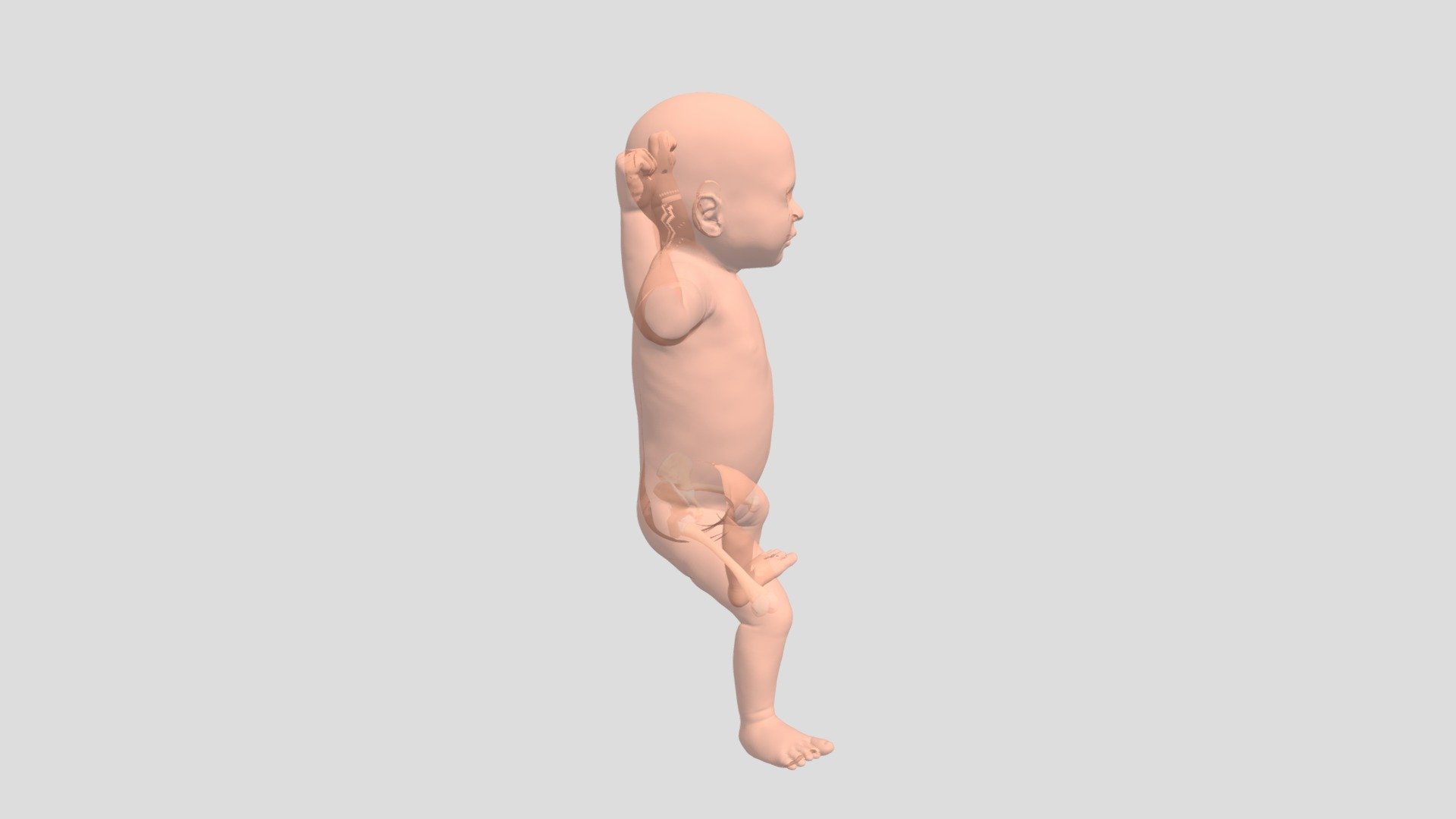 Transparent baby with hip dysplasia