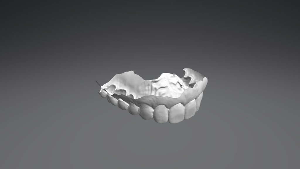 Madeleine Upper Jaw