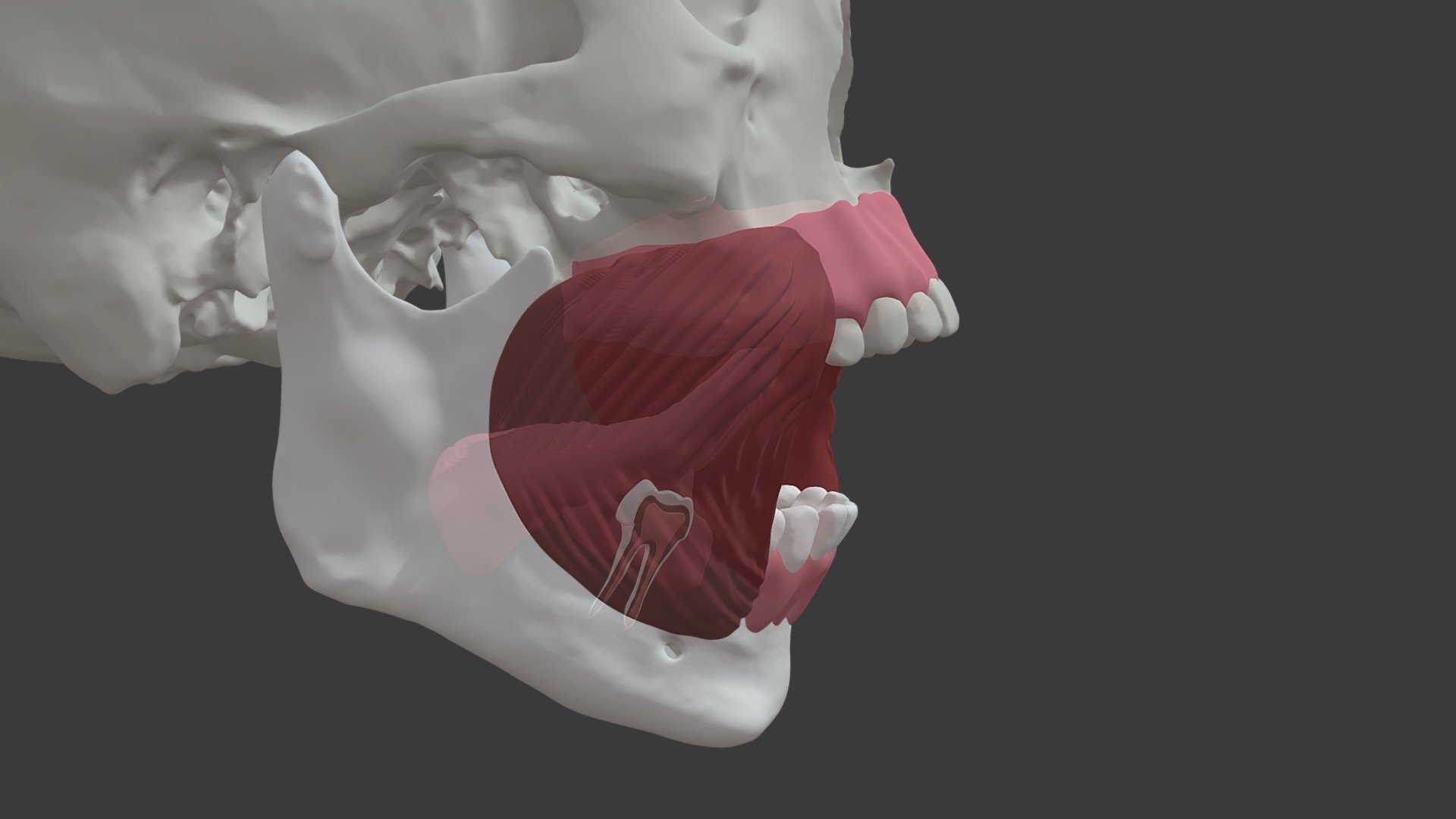 Stage 1- Mandibular Molar infection pathway 4 - 3D model by University ...