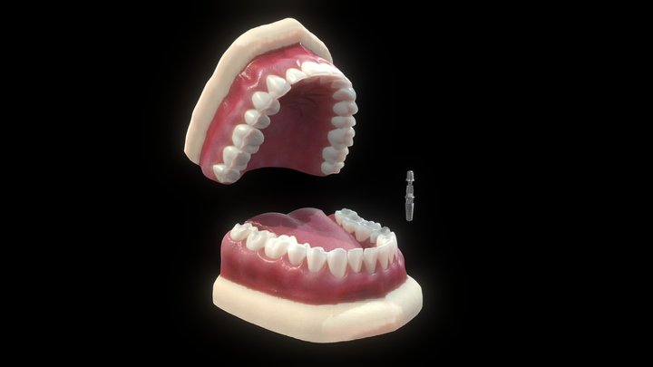 Orthodontic Implant 3D Model