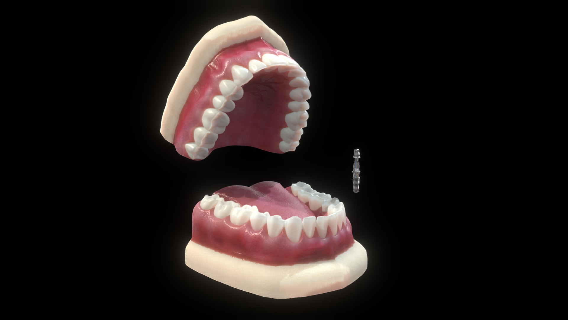 3D model Orthodontic Implant - This is a 3D model of the Orthodontic Implant. The 3D model is about two pink and white ice cream cones.