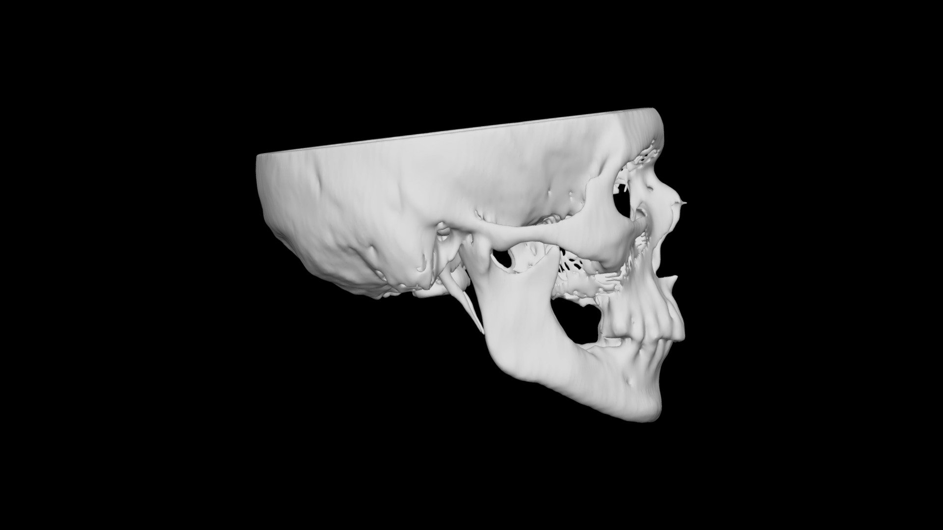 Skull Male 66yo