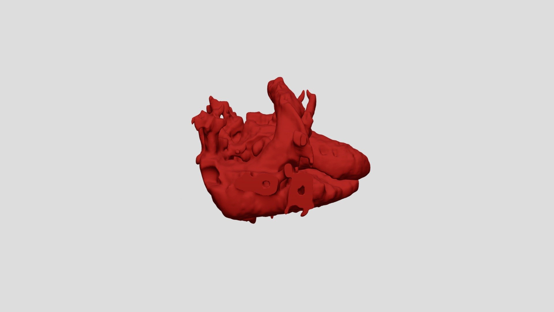 Morales PDA stent - 3D model by cathlab [7f6529e] - Sketchfab