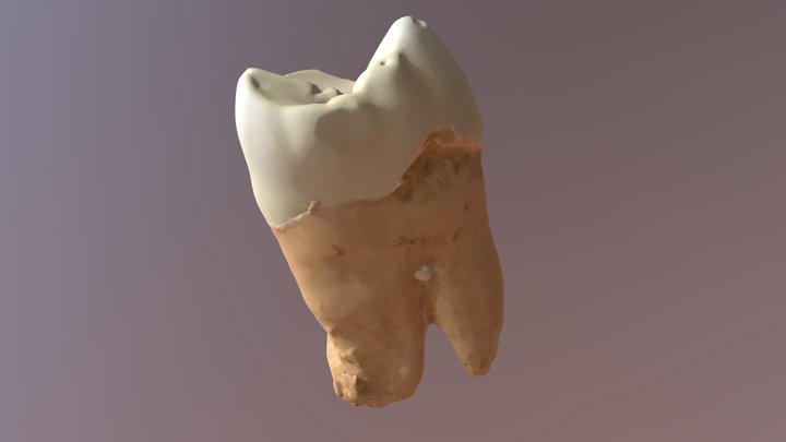QMUL Quest tooth 3D Model