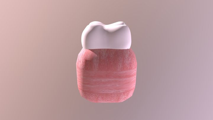 牙凹 3D Model
