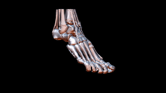 # 042 Right Foot Tendons 3D Model