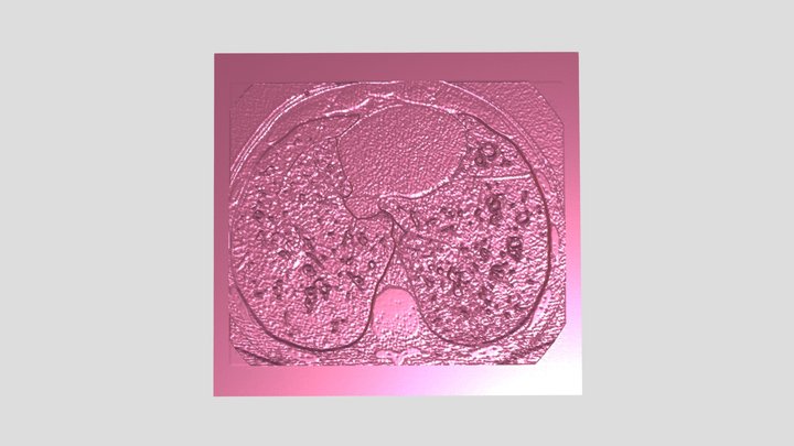 poljradiol-81-141-g002_jpgW100H93T3V4B0A0C0PS 3D Model