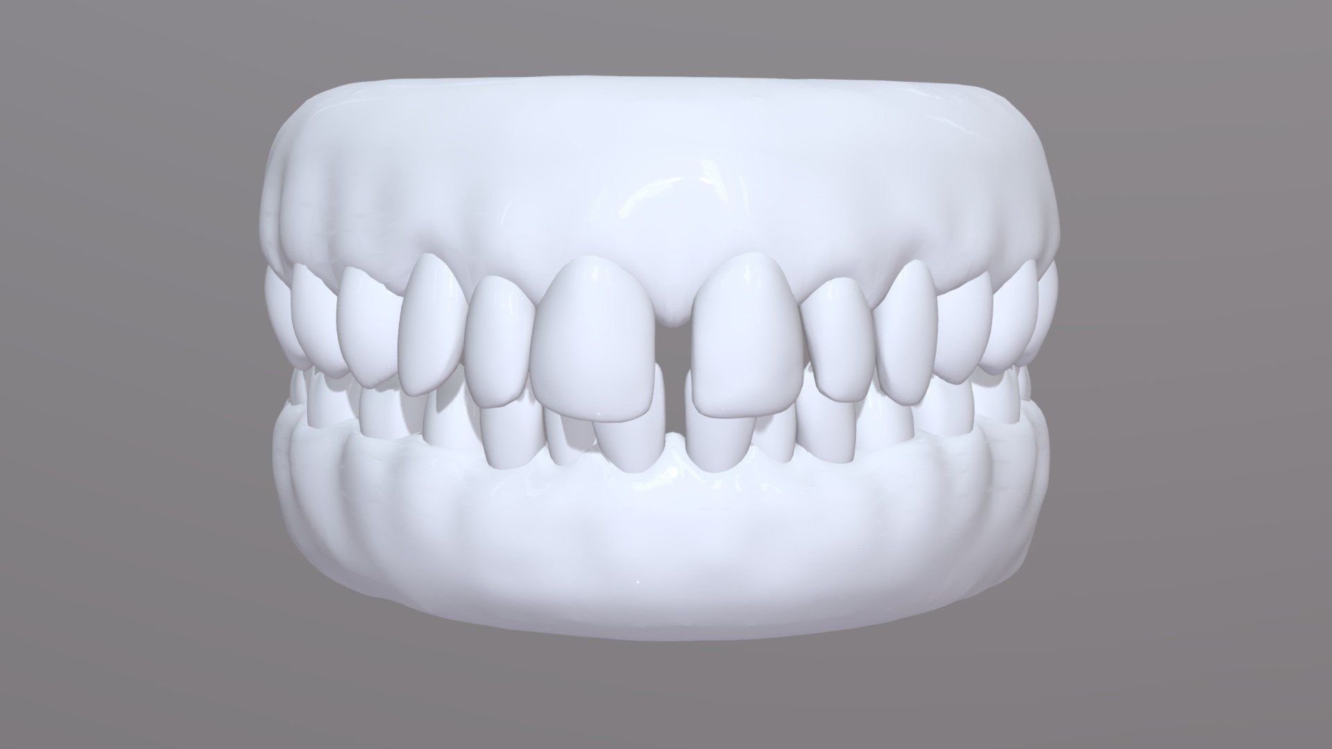 Spacing Animation 4 THICK TEETH - 3D model by dancoveycreative [8007ba1 ...