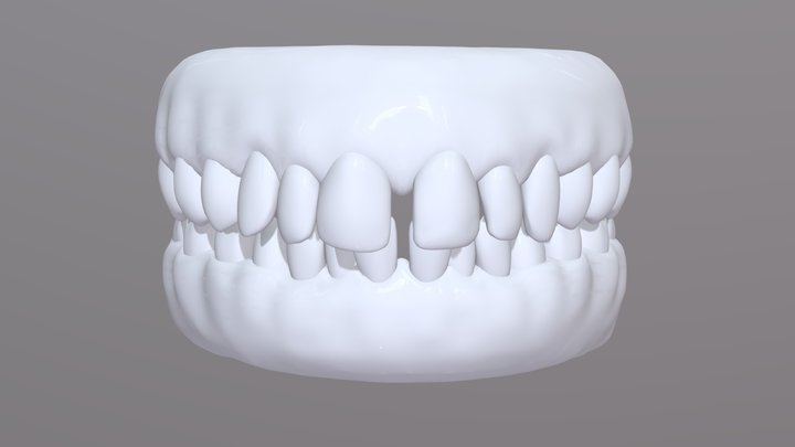 Spacing Animation 4 THICK TEETH 3D Model