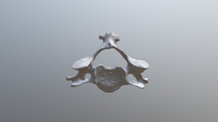 Cervical vertebra (C3 - C6) 3D Model