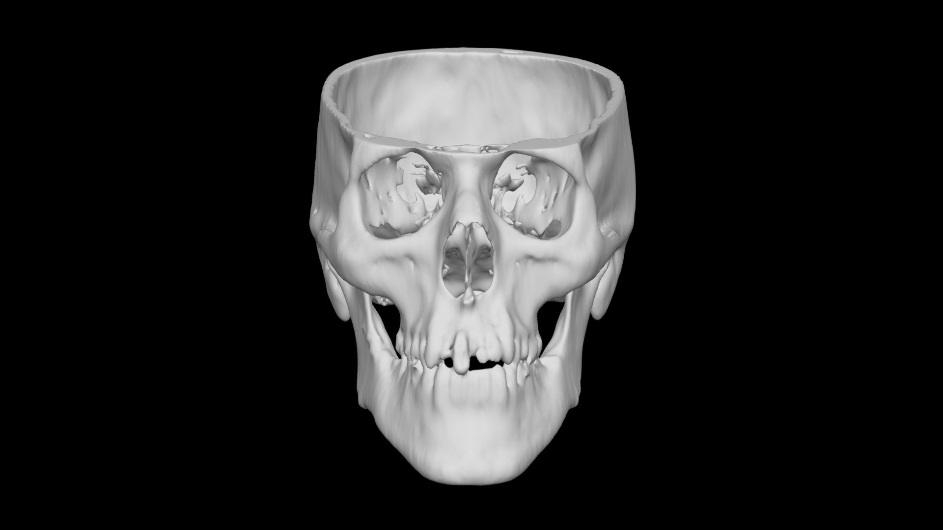 Skull Male 54yo