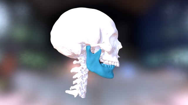 IMDO BiMax (Before) 3D Model