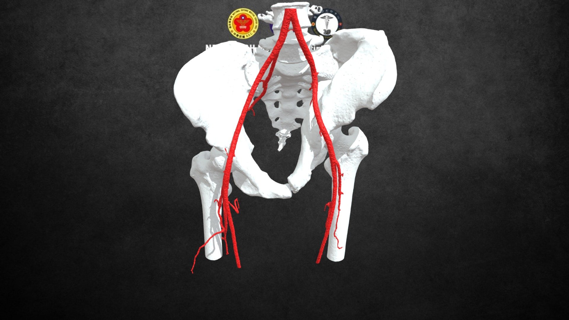 pelvis&artery