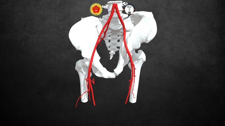pelvis&artery 3D Model