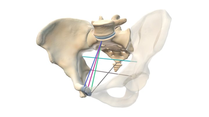 Pelvic Measurements All 3D Model