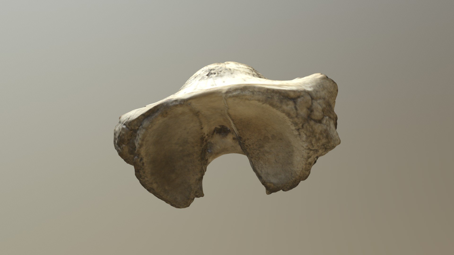 3603 Whale Vertebra (VCU_3D_3603)