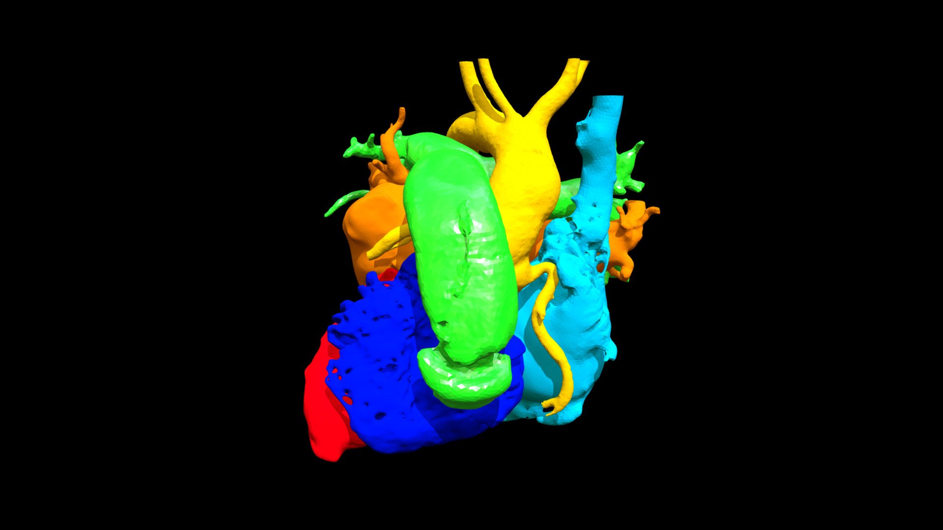 2018003-02 TGA, Dextro SI Post RV-PA Conduit - 3D model by APIL (@apil ...