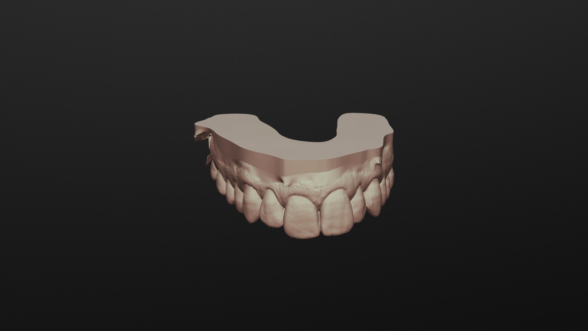 Upper teeth