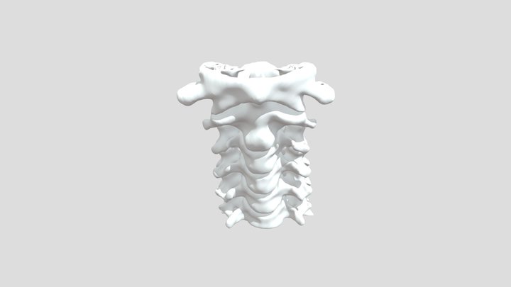 Cervical Vertebrae