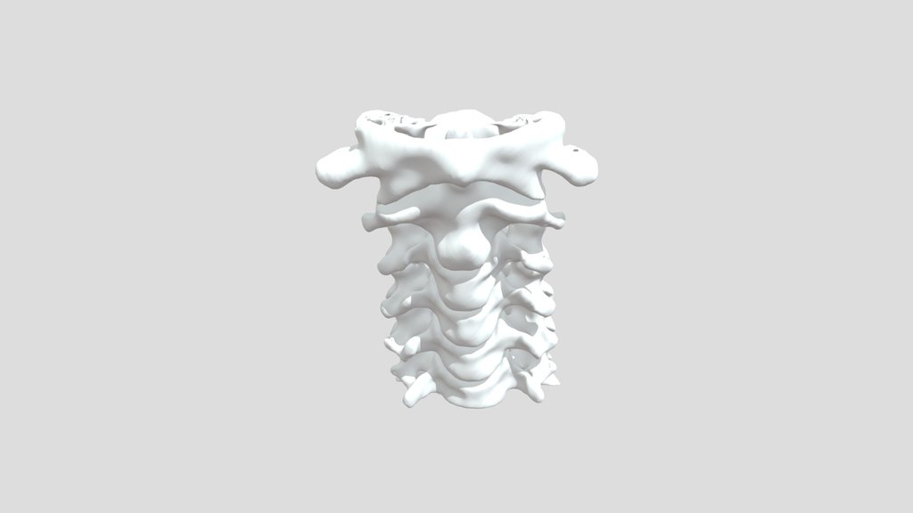 Cervical Vertebrae