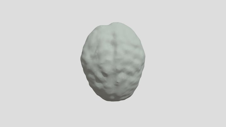 MR_Tumors 3D Model