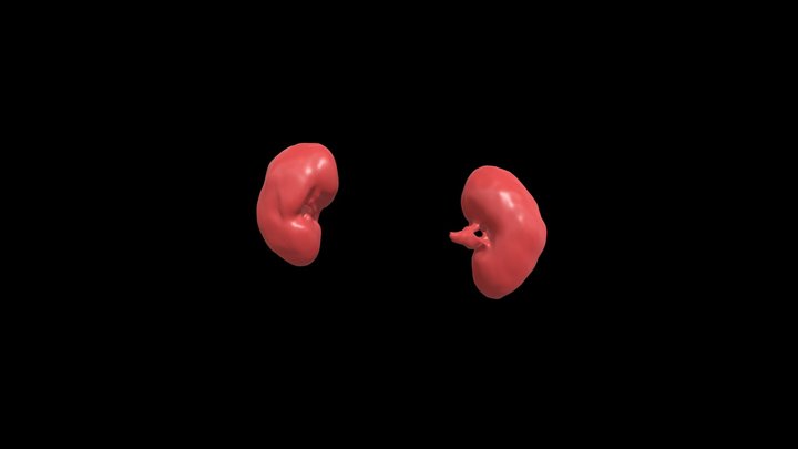 Segmentation_Kidney 3D Model
