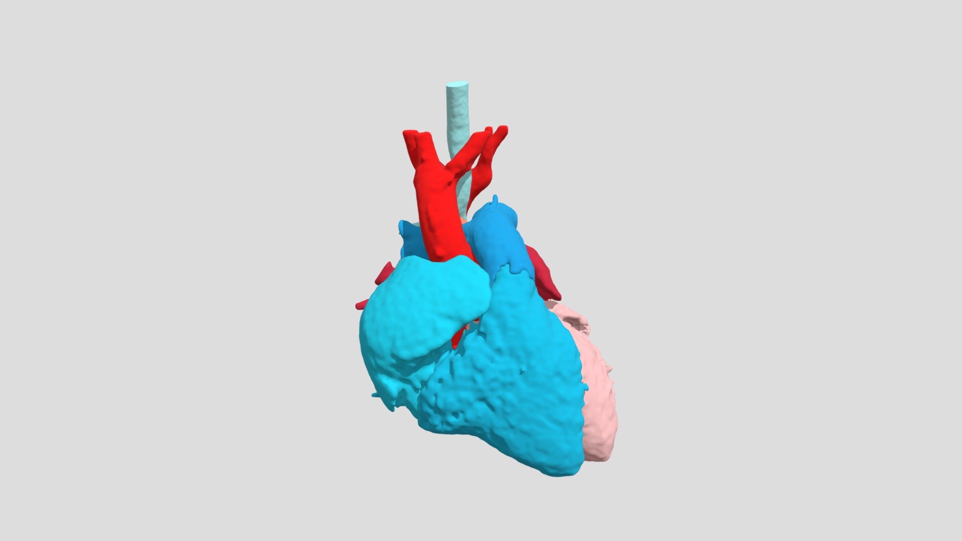 Vascular Ring with Right Aortic Arch (S0348) - 3D model by NCHS Cardiac ...