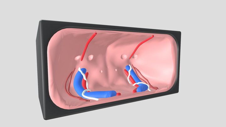 simulador de hérnia inguinal bilateral 3D Model
