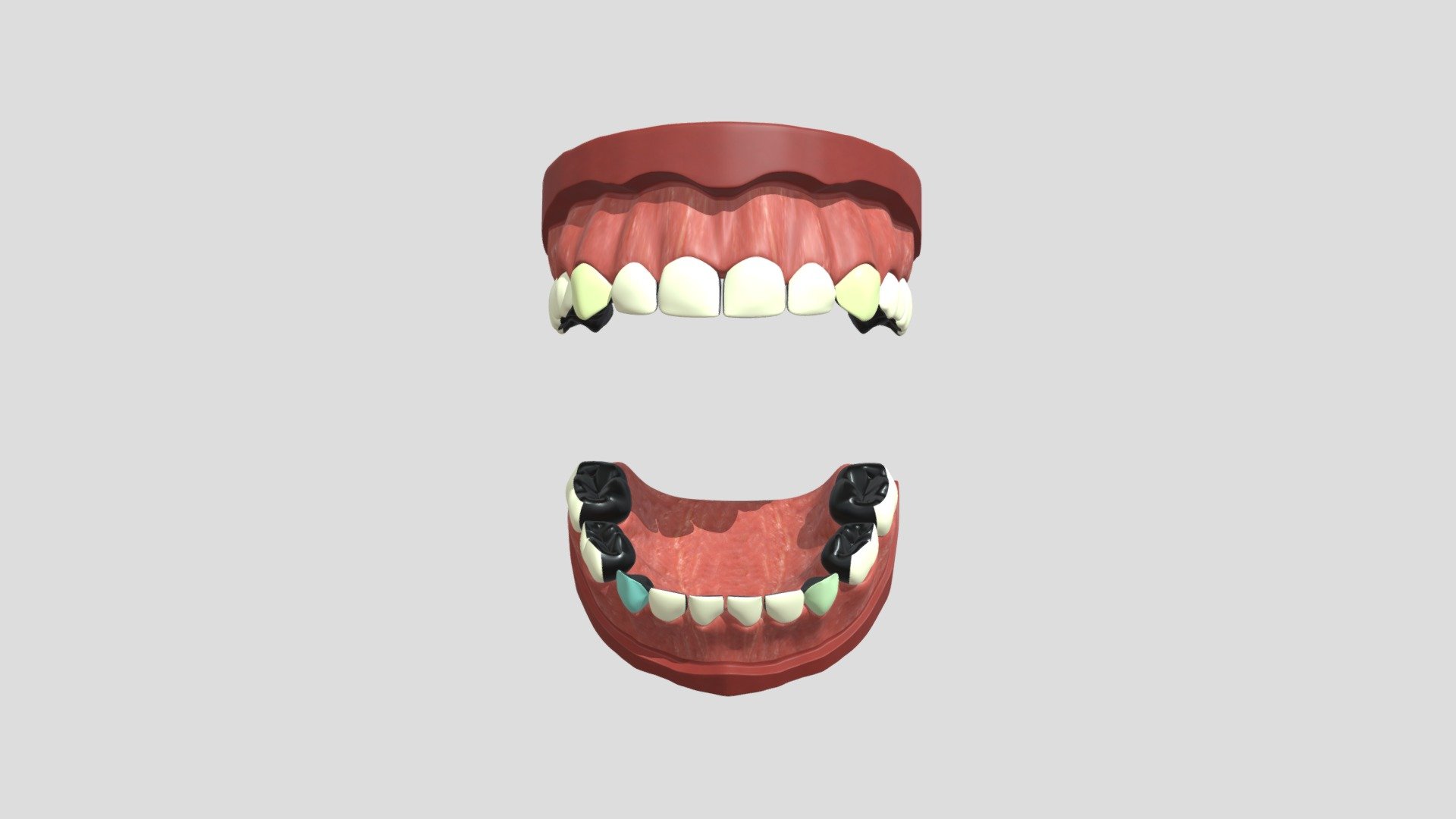 hypo_nzunrestored_1cm_1c