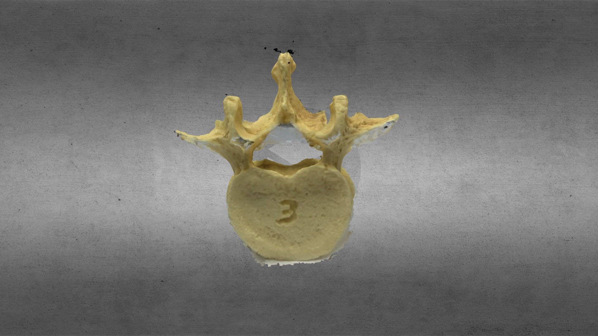 Lumbar Vertebra Model