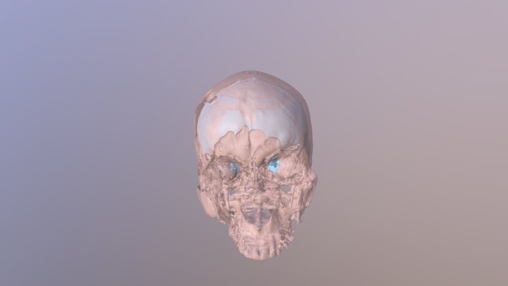 Brain & Skull CT 3D Model