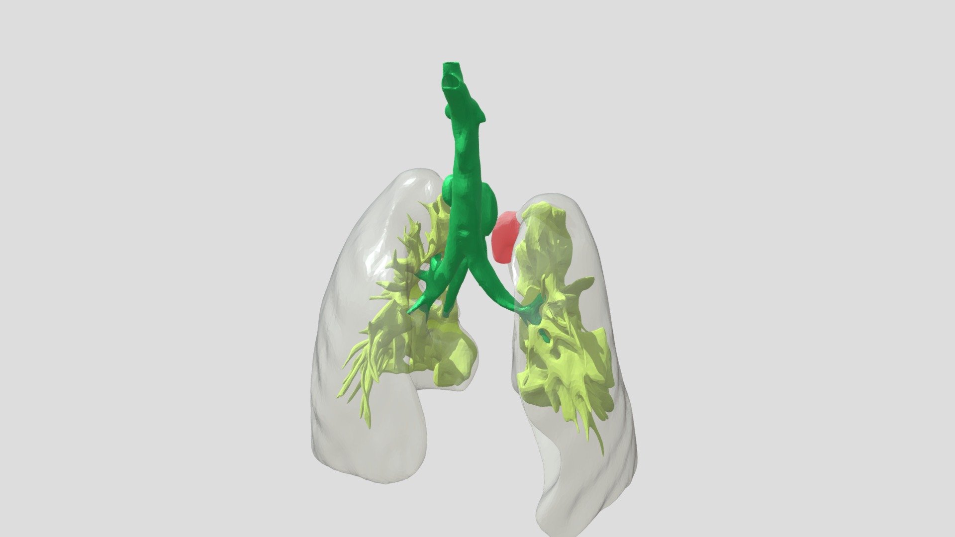 ORL01SS02122020_Malformazione Genetica Trachea