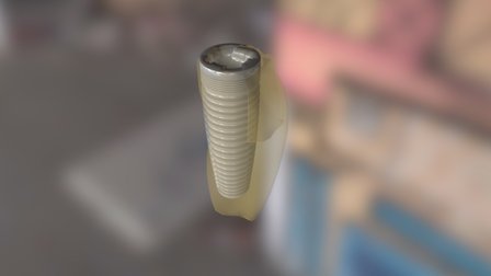 What is the Socket Shield Technique? 3D Model