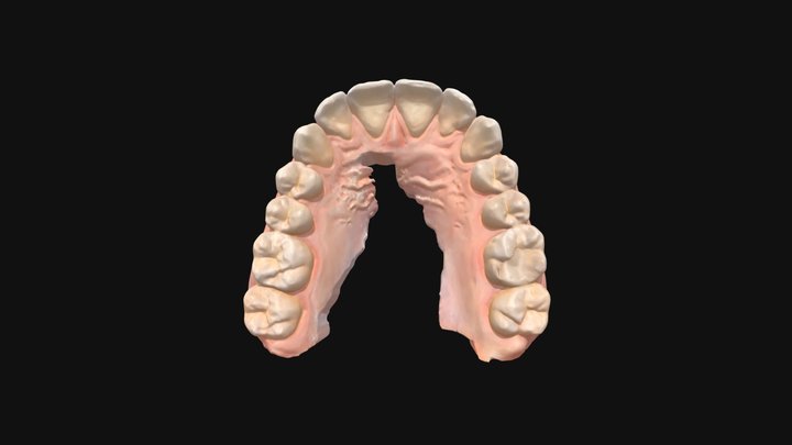 Caso practico resuelto- Arcada superior 3D Model