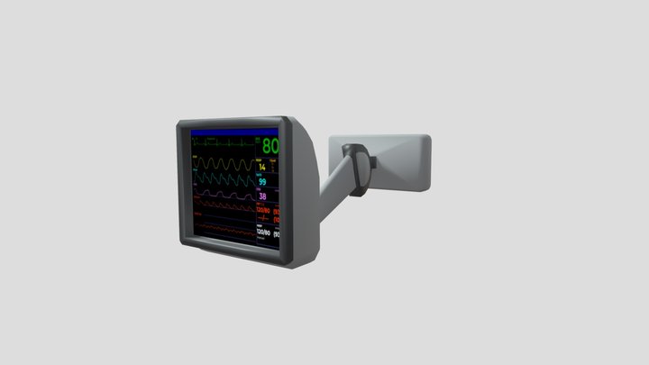 Wall-Mounted Hospital Tracking Monitor – Modelo 3D gratuito STL